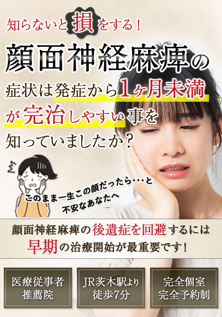 顔面神経麻痺の症状は発症から1年未満が完治しやすい事を知っていましたか？